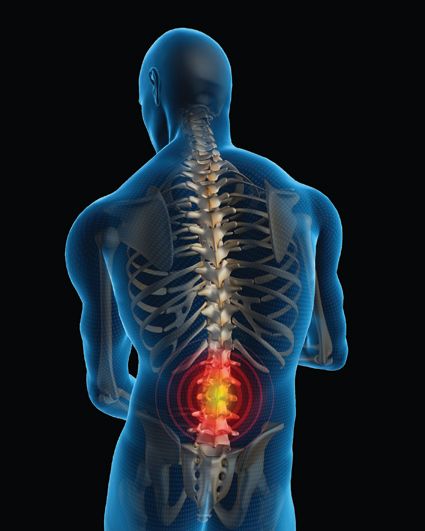 Digital illustration of a human figure highlighting lower back pain in red and yellow, emphasizing the need for relief with The Original BackMagic with Thermal Gel Heat Pads.