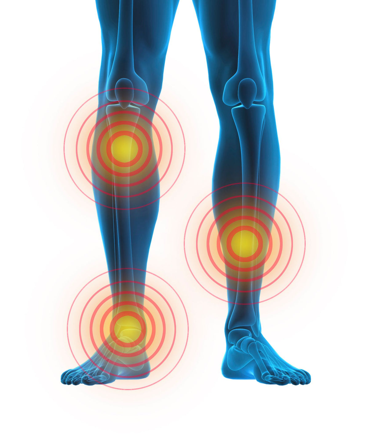 An illustration of legs with highlighted pain points at the knees and ankles, ideal for showing areas addressed by the Circulation Plus Active Lower Leg & Foot Exerciser (2025) and offering helpful visual guidance for its use.